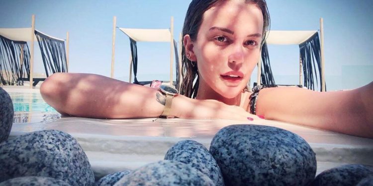 Dolgu yüzünden kör oluyordu 1 Dolgu yüzünden kör oluyordu