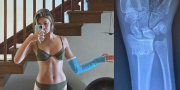 Kaia Gerber karantinada kolunu kırdı 7 Kaia Gerber karantinada kolunu kırdı