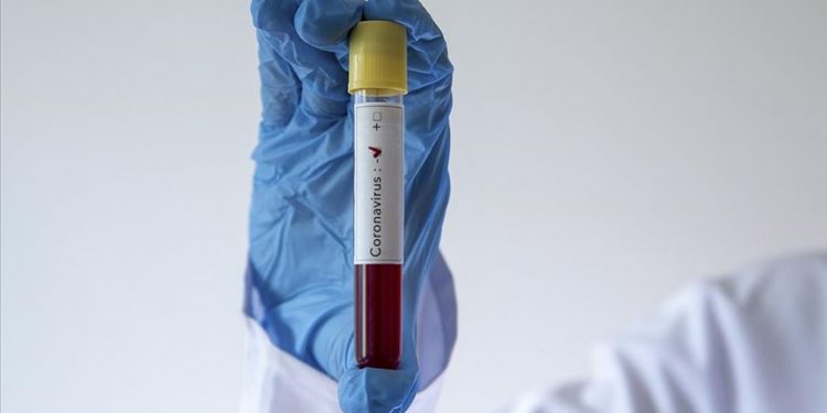 Galatasaray’ın corona virüs test sonucu çıktı 1 Galatasaray’ın corona virüs test sonucu çıktı