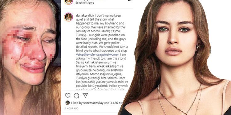 Ünlü top model Çeşme’de dayak yedi 1 Ünlü top model Çeşme’de dayak yedi