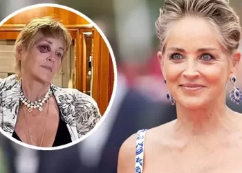 Bodrum'da tatil yapan Sharon Stone'un gözü mosmor oldu