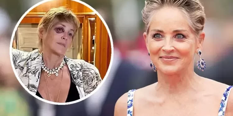 Bodrum'da tatil yapan Sharon Stone'un gözü mosmor oldu 1 Bodrum'da tatil yapan Sharon Stone'un gözü mosmor oldu