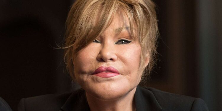 "Kedi Kadın" Jocelyn Wildenstein Paris'te hayatını kaybetti 1 Estetik operasyonlarıyla "Kedi Kadın" olarak anılan Jocelyn Wildenstein, Paris'te geçirdiği akciğer embolisi sonucu hayatını kaybetti.